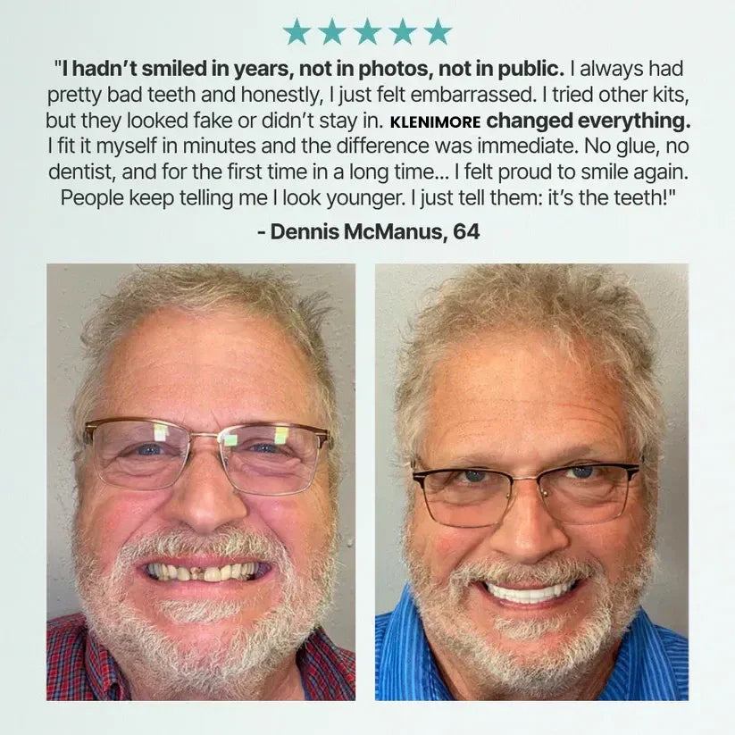 Custom-Fit Instant Smile Dentures – Natural Looking Comfort Fit